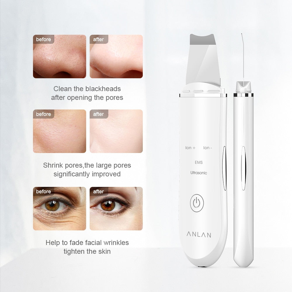 Accessories/ Ultrasonic Skin Lift Machine