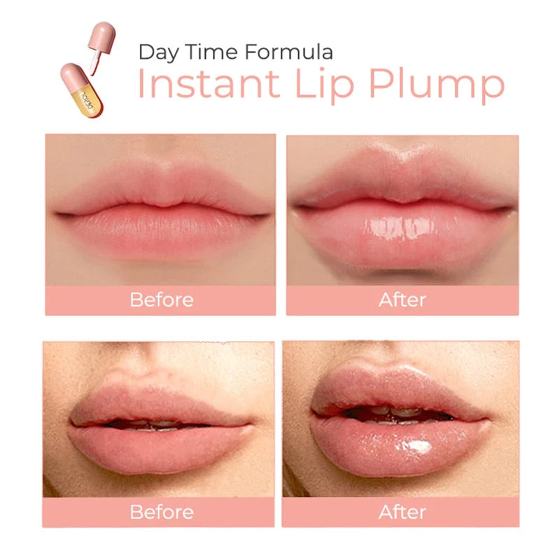 Lip/ DEROL™ Lip Plumper Kit