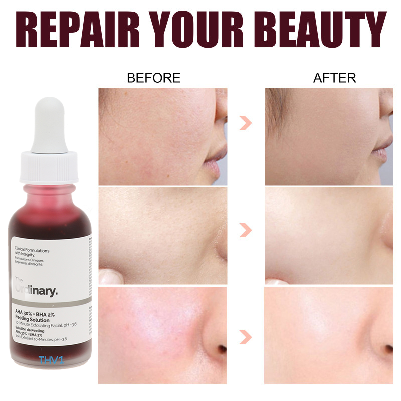 Face/ Ordinary Peeling Solution AHA 30% + BHA 2%