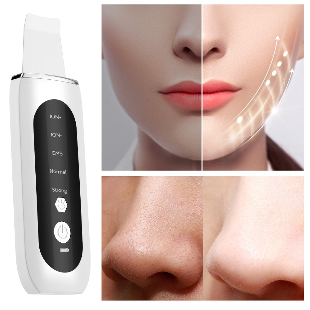 Face/ Ultrasonic Face Skin Scrubber