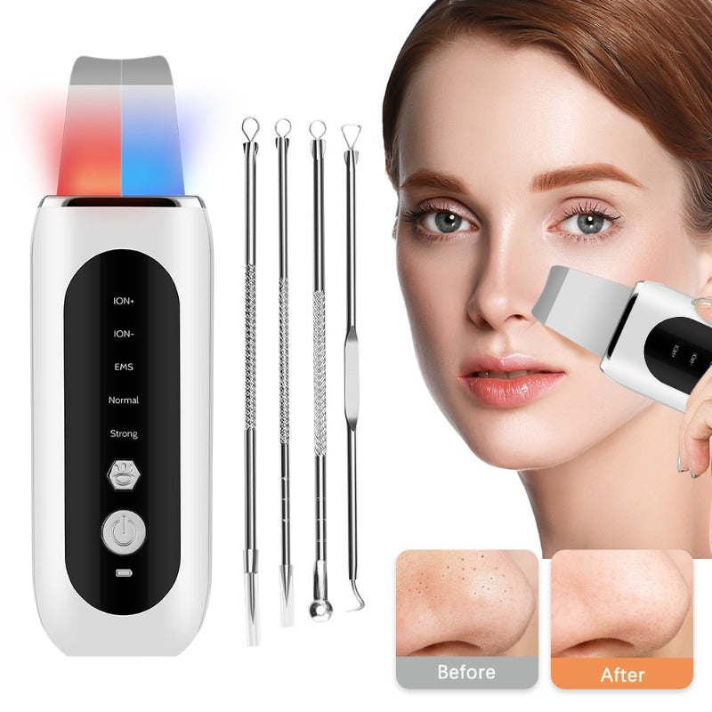 Face/ Ultrasonic Face Skin Scrubber