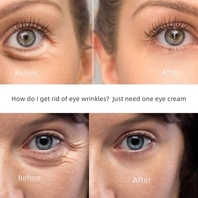 Eye/ New Anti-Wrinkle Eye Cream